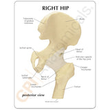 Basic Hip Education Card