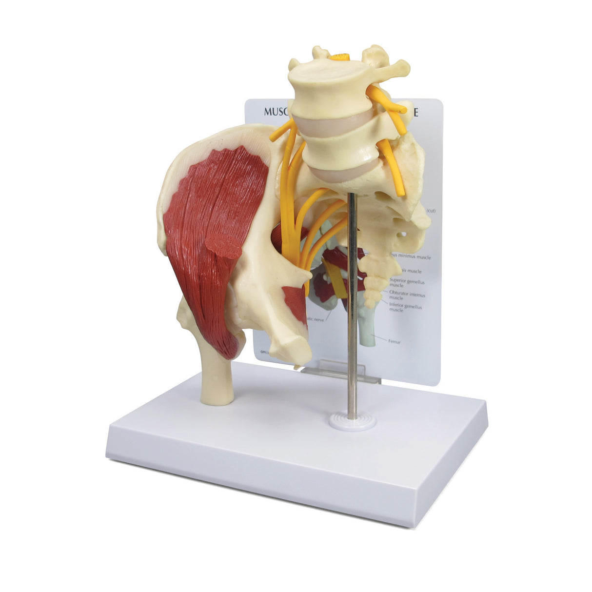 Muscled Hip Model with Sciatic Nerve