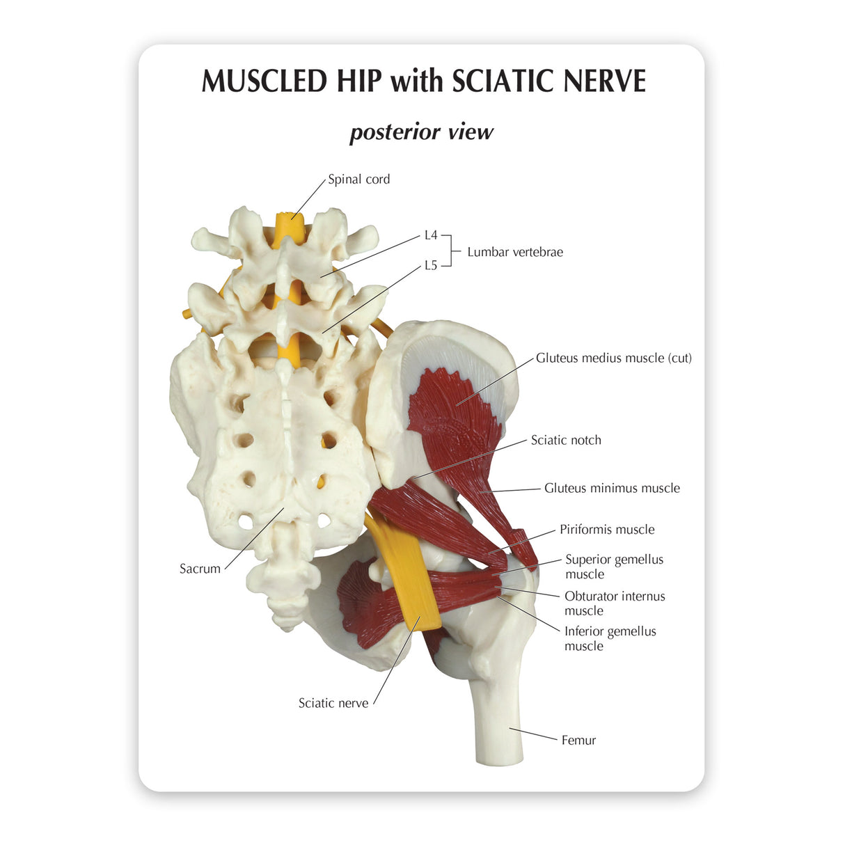 Muscled Hip with Sciatic Nerve Education Card