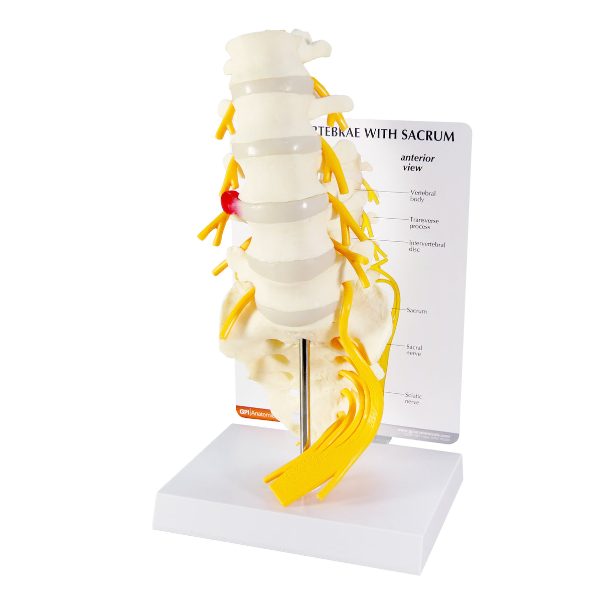 5-Piece Vertebrae Model with Sacrum