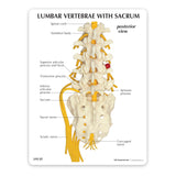 5-Piece Vertebrae Model with Sacrum