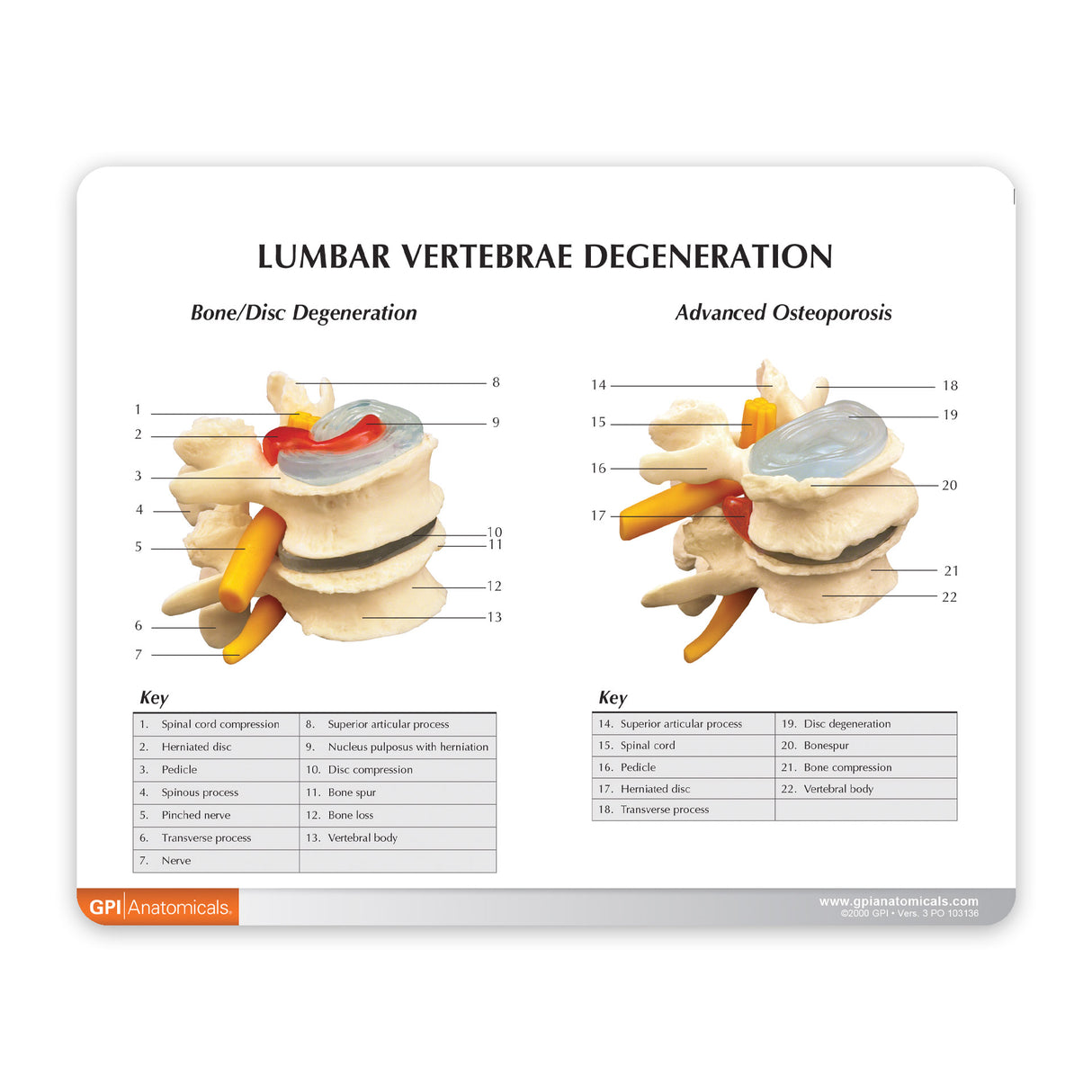 4-Stage Vertebrae Model