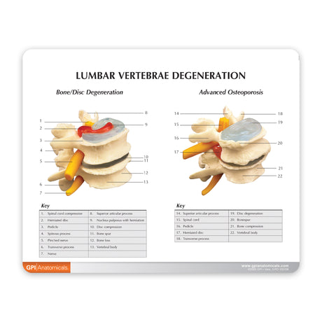 4-Stage Vertebrae Education Card