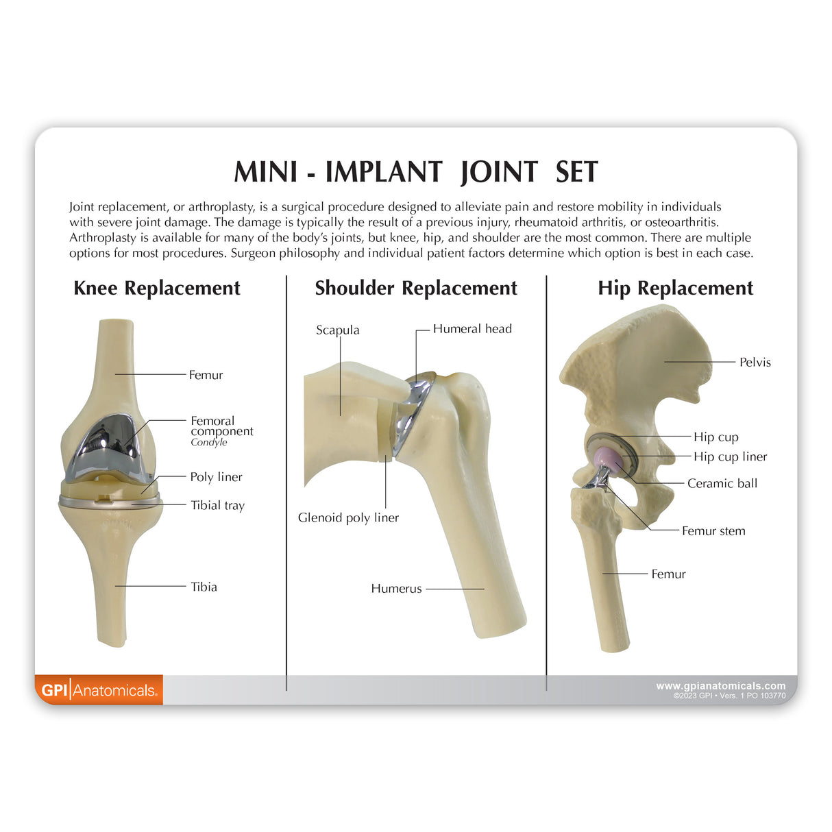 Mini Implant Joint Set