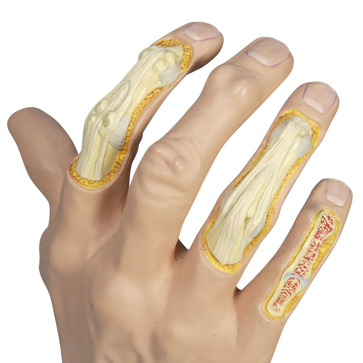 Right Hand Model with Osteoarthritis (OA)