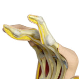 Right Hand Model with Rheumatoid Arthritis