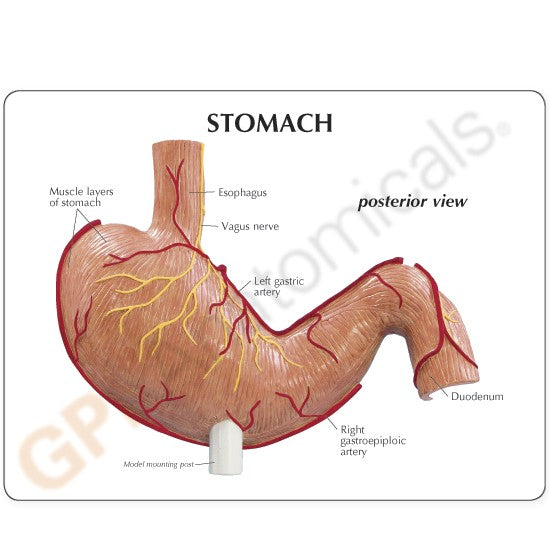 Stomach Model with Ulcers