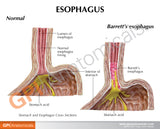 4-Piece Stomach Education Card