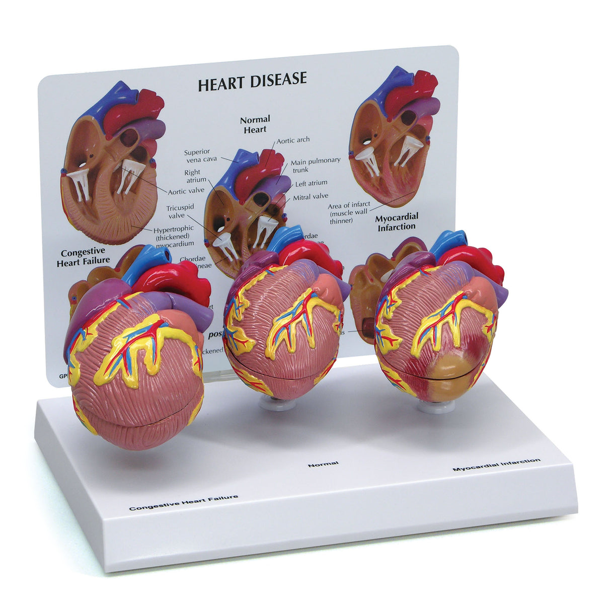 3-Piece Mini Heart Model Set