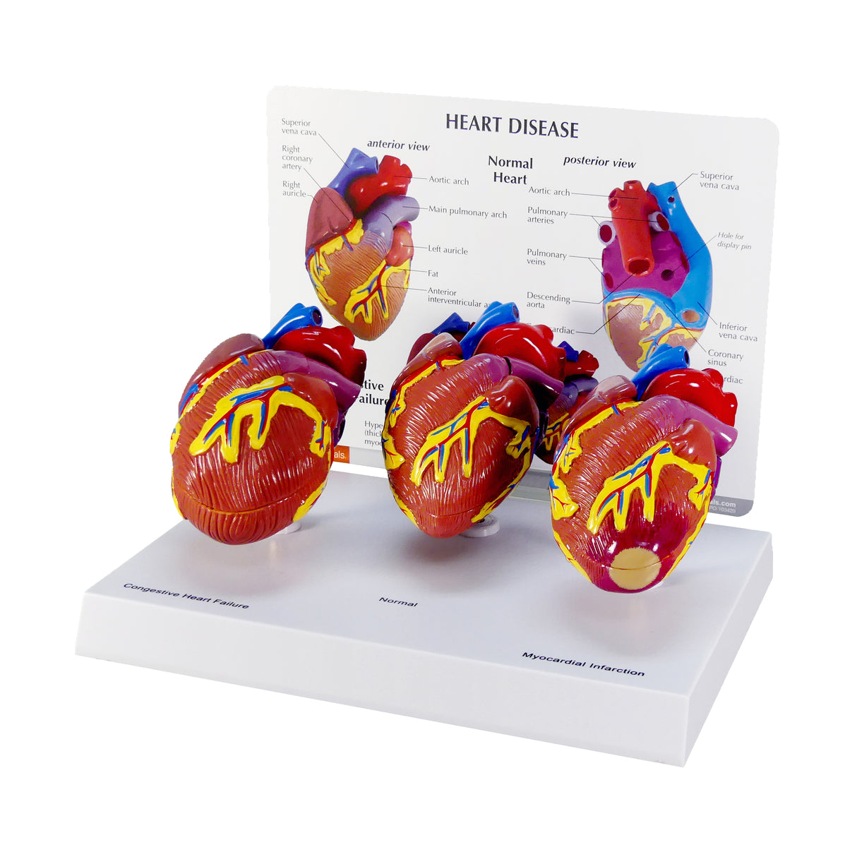 3-Piece Mini Heart Model Set