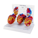 3-Piece Mini Heart Model Set