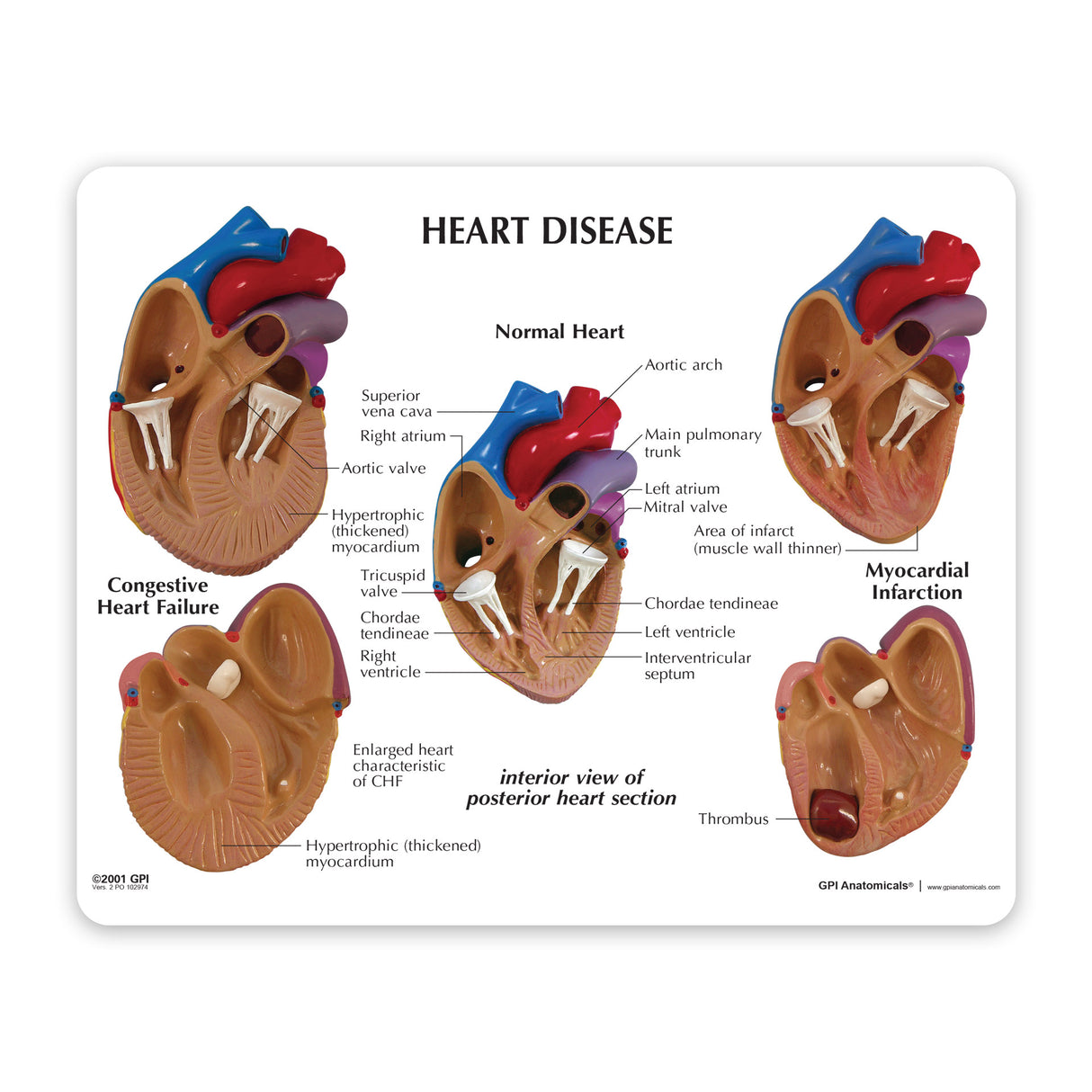 3-Piece Mini Heart Set Education Card