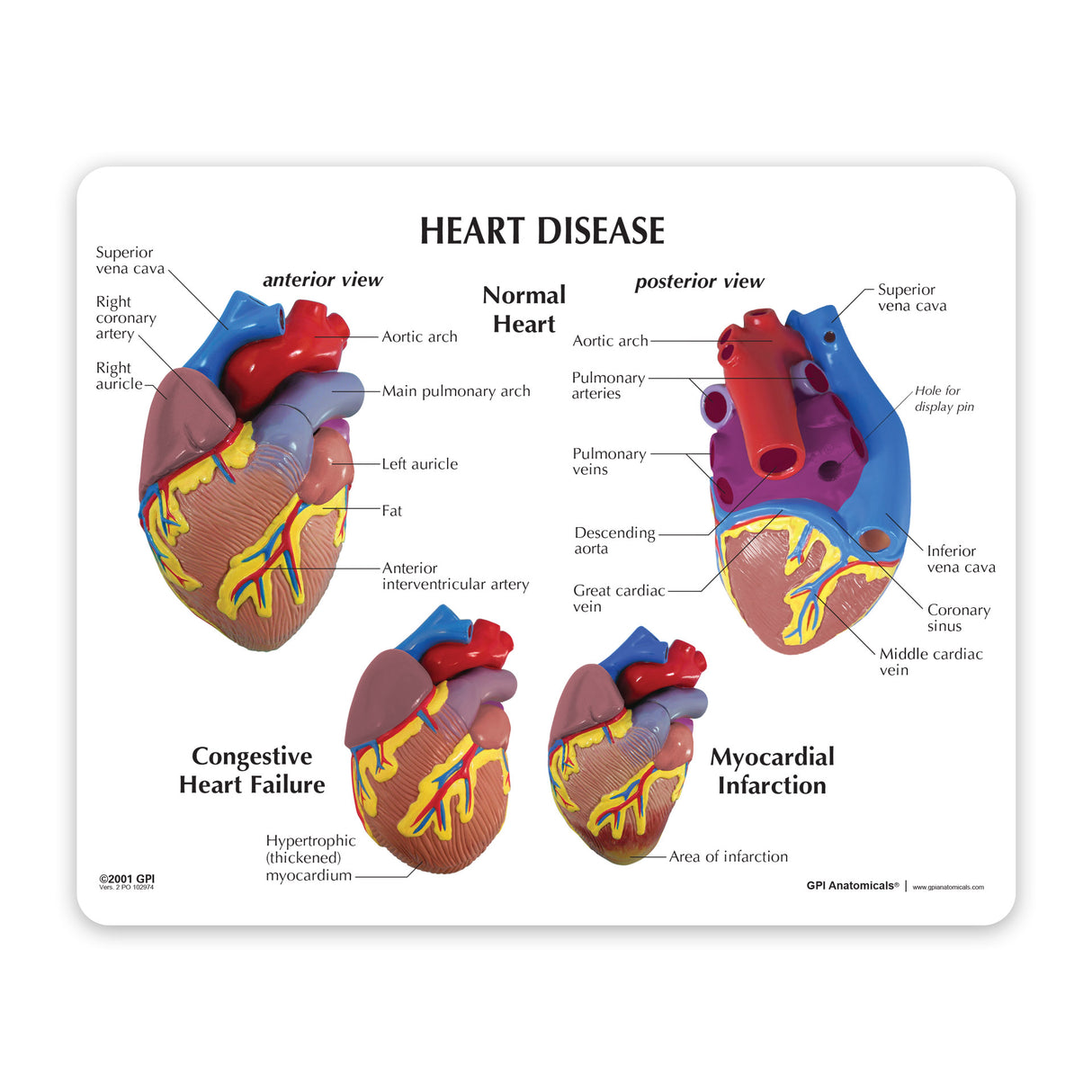 3-Piece Mini Heart Model Set