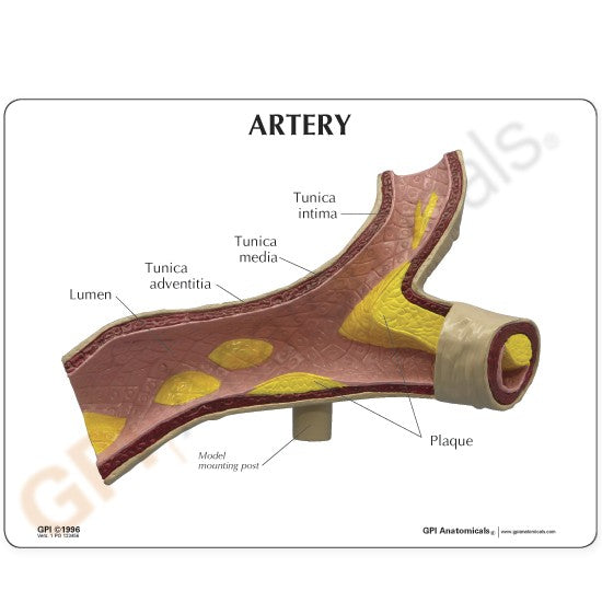 Artery Education Card