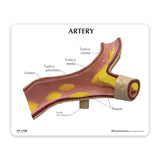 Artery Model