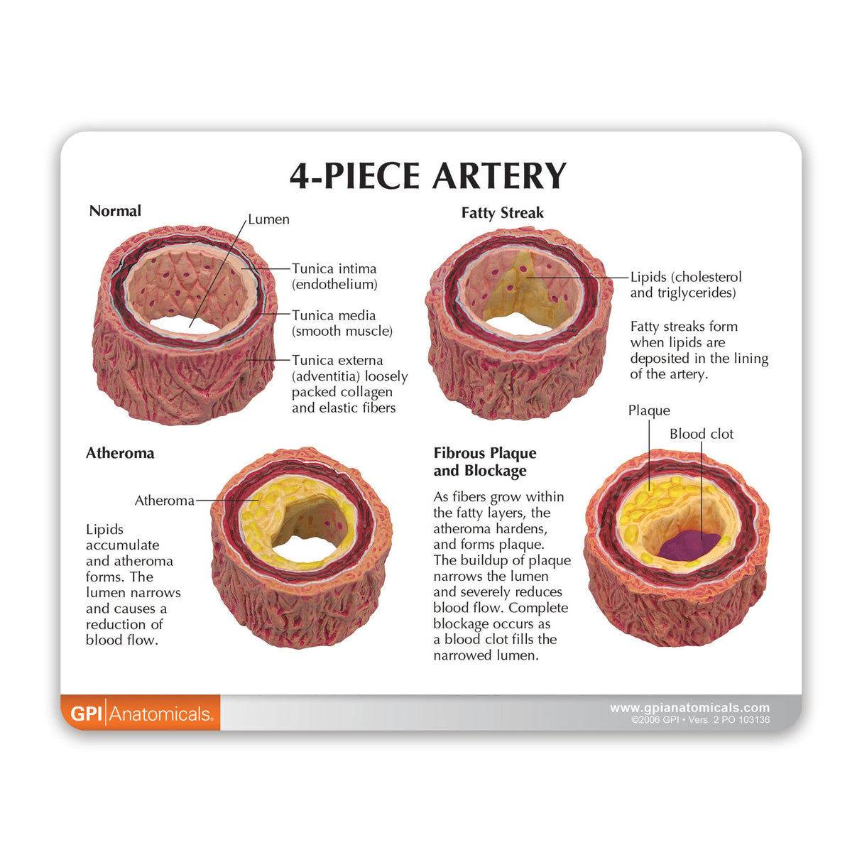 4-Piece Artery Education Card