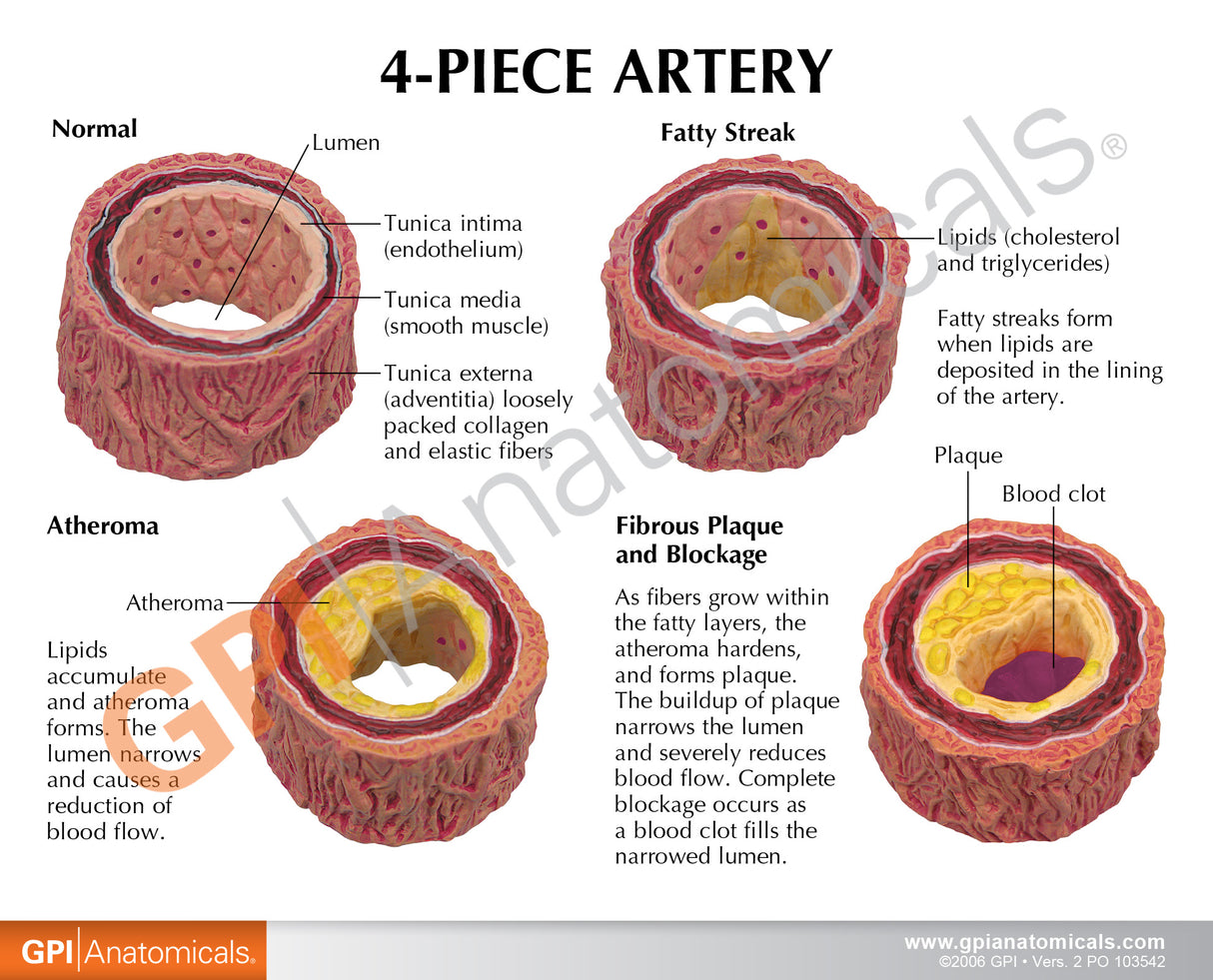 4-Piece Artery Education Card