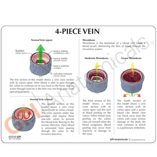 4-Piece Vein Model with Blood Clot