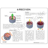 4-Piece Vein Model with Blood Clot