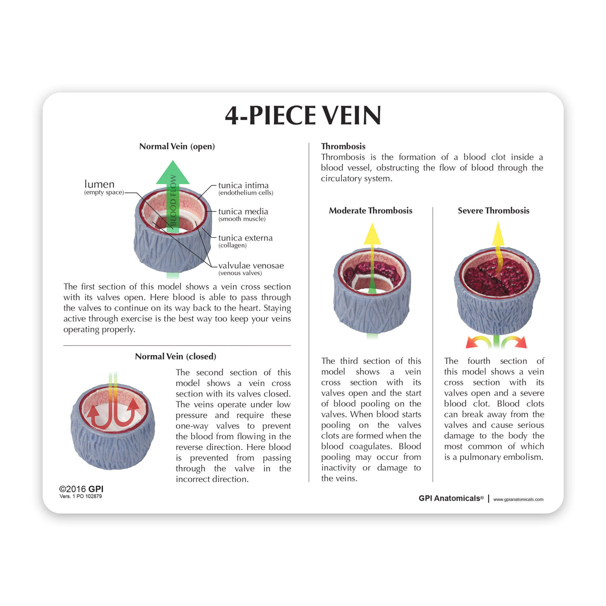 4-Piece Vein Model with Blood Clot