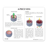 4-Piece Vein Model with Blood Clot