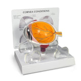 Cornea Eye Model