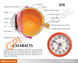 Cataract Eye Education Card