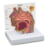 Sinus Model