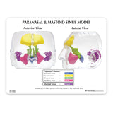 Clear Sinus Model