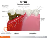 Teeth Model