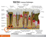 Teeth Model