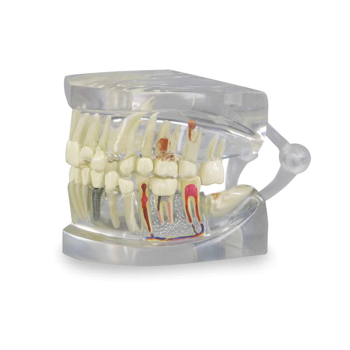 Teeth Model, Clear