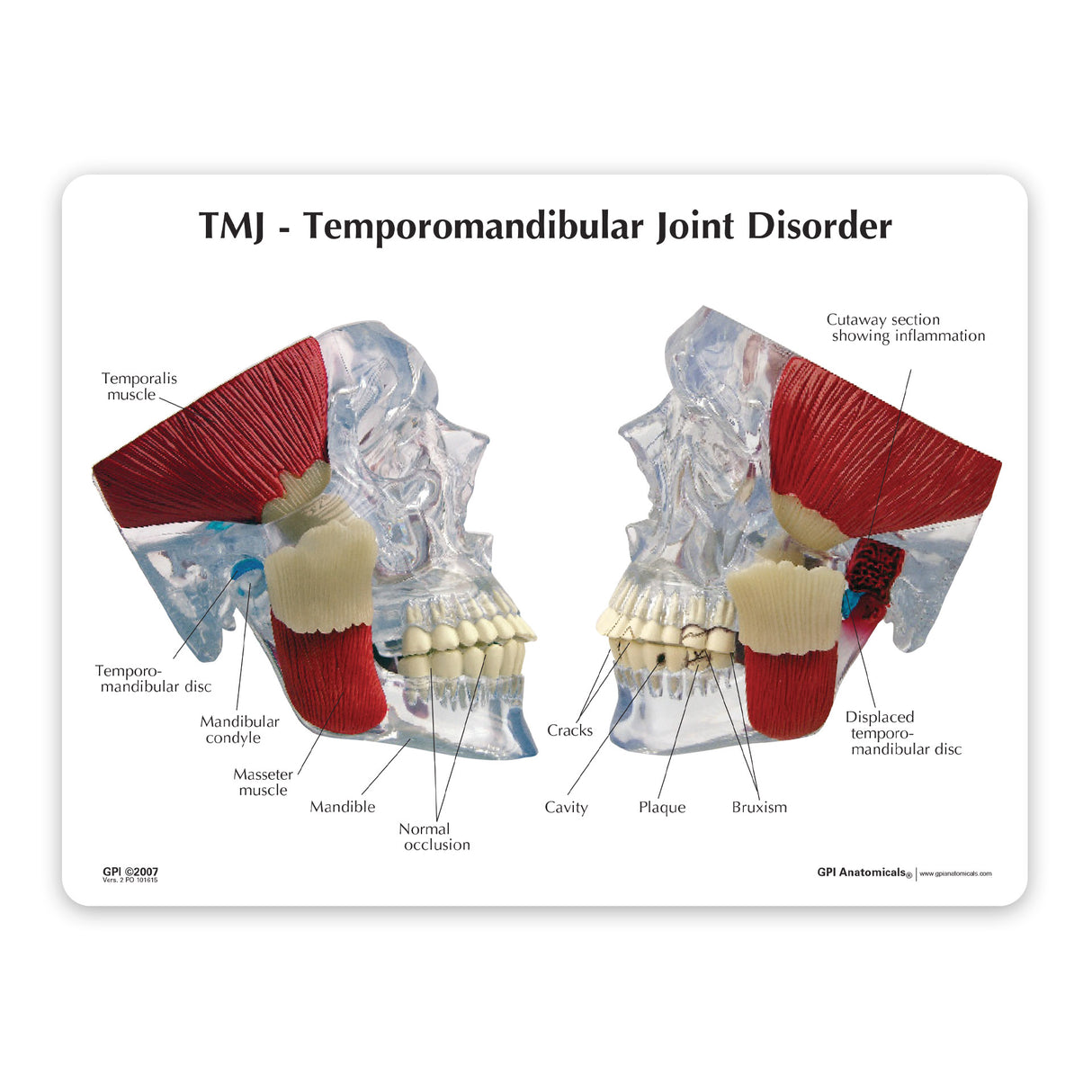 Temporomandibular Joint (TMJ) Model