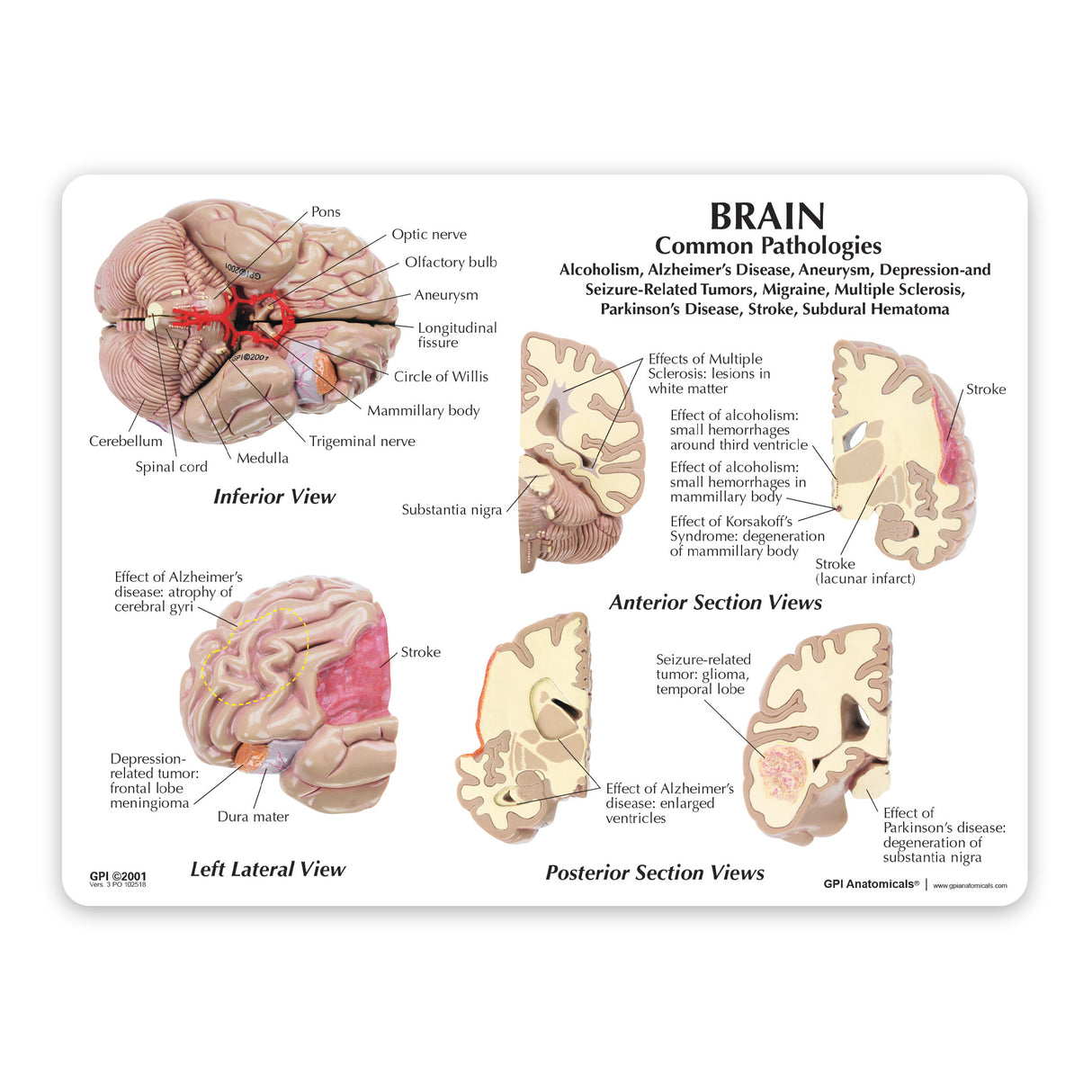 Brain with Partial Skull Model