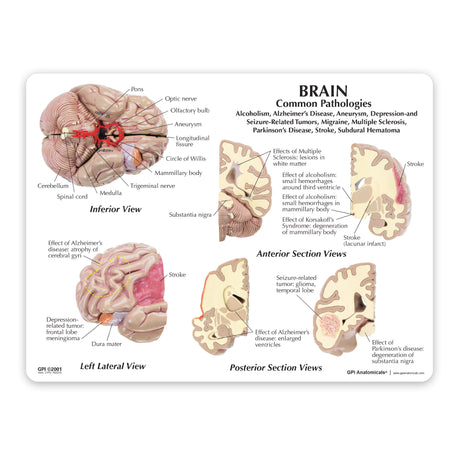 Brain with Partial Skull Education Card