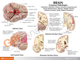 Brain with Partial Skull Model