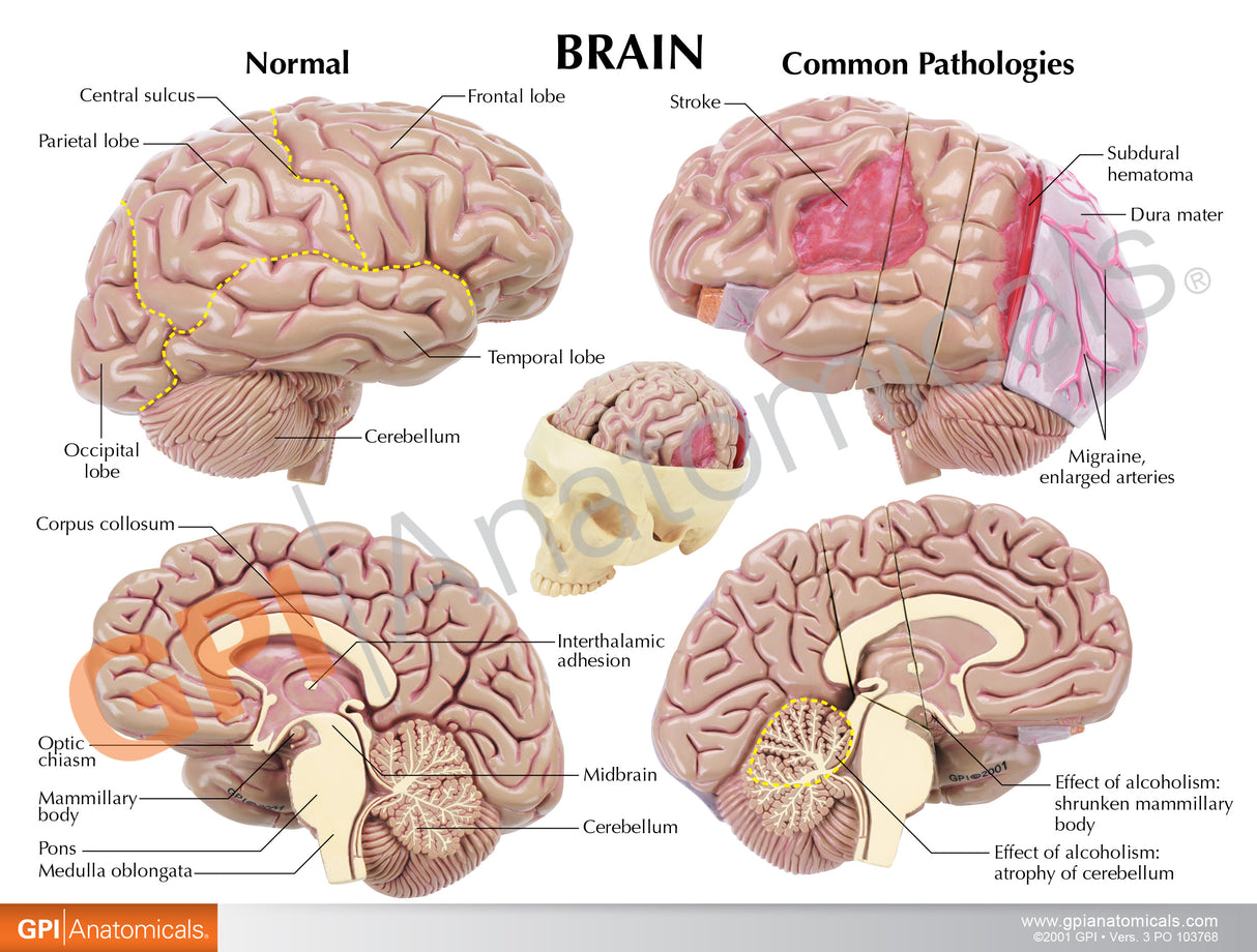 Brain with Partial Skull Education Card