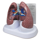 Lung Model Set with Pathologies