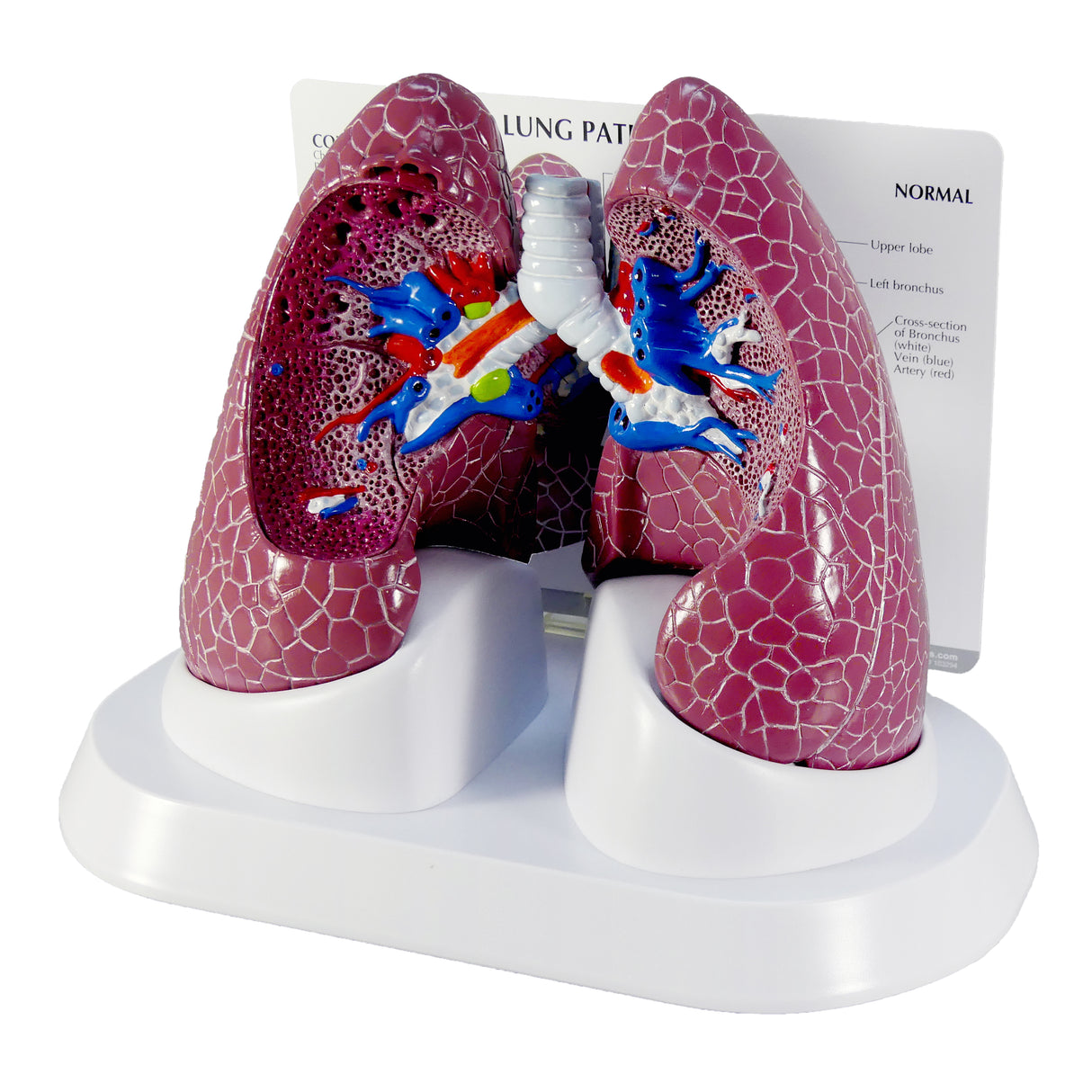 Lung Model Set with Pathologies