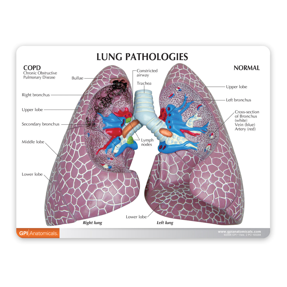 Lung Model Set with Pathologies