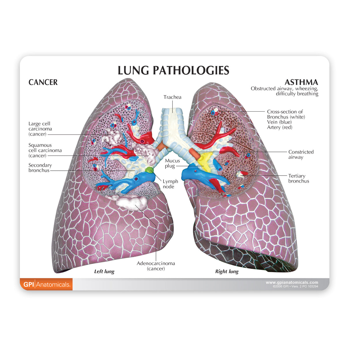 Lung Cancer Education Card