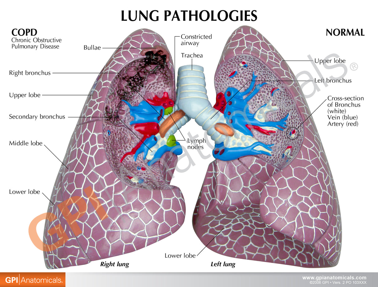 Lung Cancer Education Card