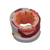 4-Piece Bronchus Model