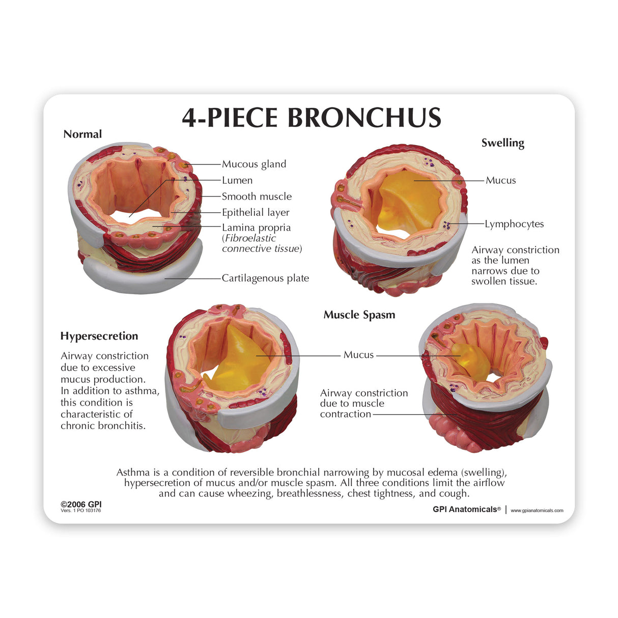 4-Piece Bronchus Education Card