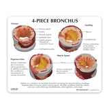 4-Piece Bronchus Model