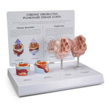 Respiratory System Model with Chronic Obstructive Pulmonary Disease (COPD)