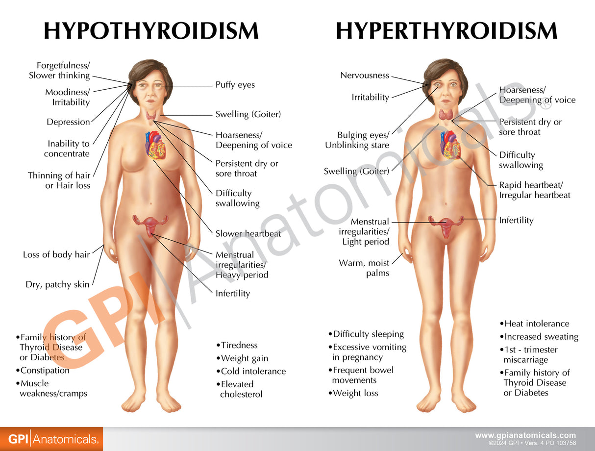 Thyroid Model Set