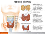 Thyroid Model Set