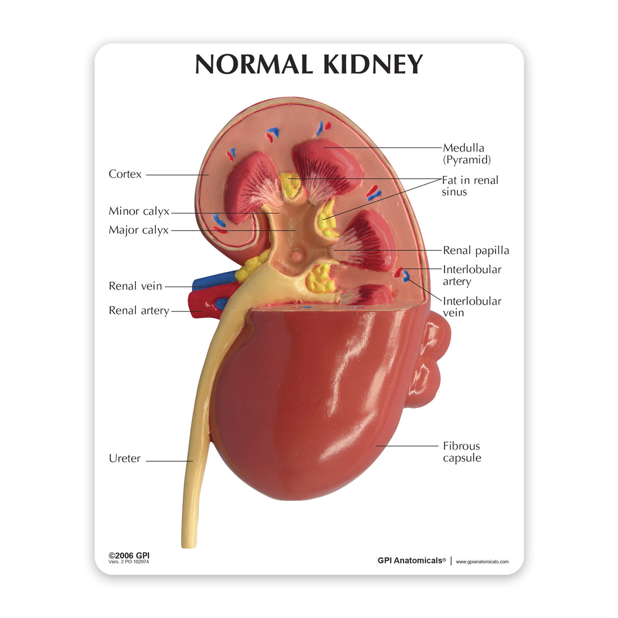 Normal and Diseased Kidney Model