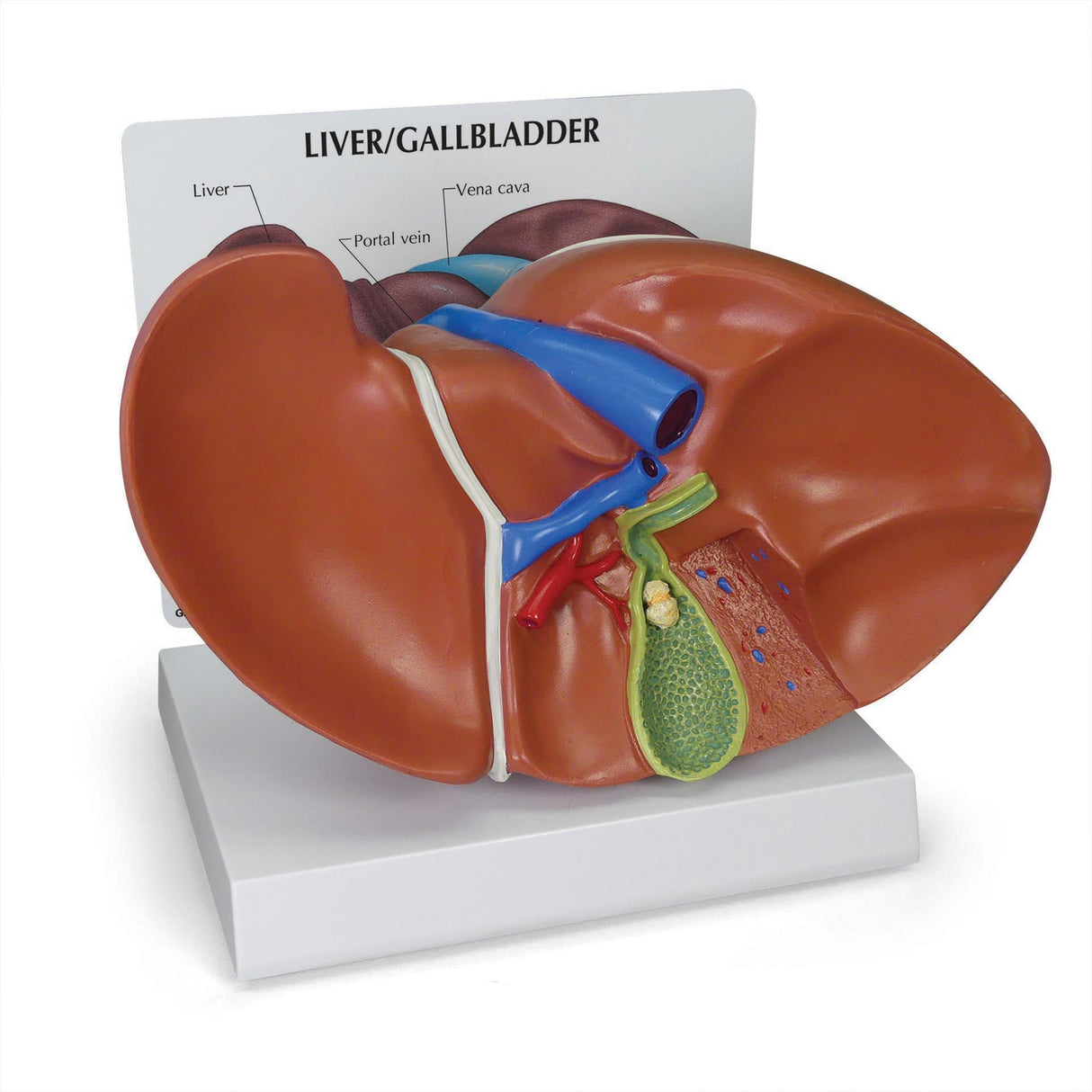 Liver and Gallbladder Model